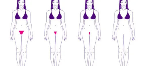 L’épilation intégrale, mauvaise pour la santé ?