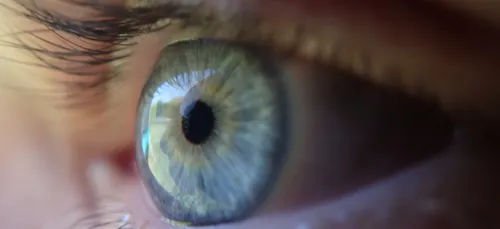 Attention à une épidémie d’infections à cause des lentilles de contact