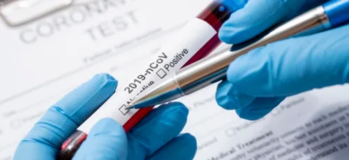 Coronavirus : second décès en Amérique Latine