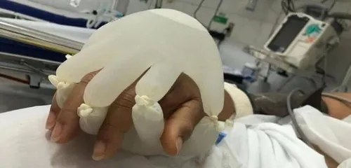 Brésil : des patients COVID réconfortés grâce à la "main de Dieu"