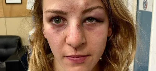 L'image choc de Margaux Pinot, championne olympique de judo