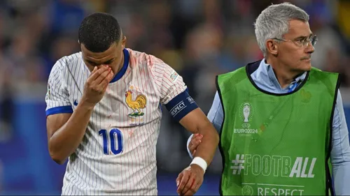 Nez cassé pour Kylian MBappé !