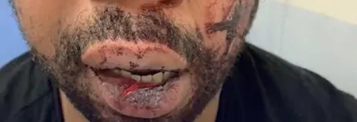 Agression du producteur par la police - De nombreuses réactions...