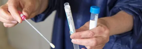 L'ARS demande aux supporters de se faire tester dans les prochains...