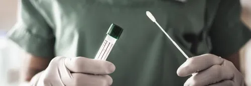 Fin de la gratuité des tests de dépistage sans prescription «...