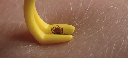 Attention aux tiques, la saison est lancée !