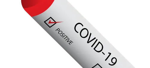 COVID-19 : situation préoccupante dans le Finistère