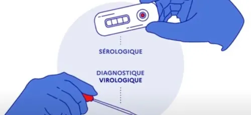 COVID-19 en Bretagne : point de situation