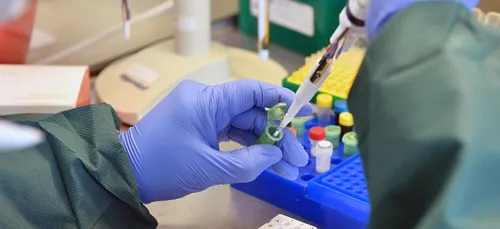 Nantes : Opération de dépistage COVID 19