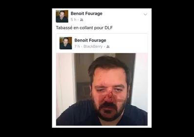 Un conseiller municipal de Sucé-sur-Erdre passé à tabac à Nantes...