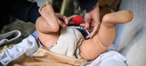 Locon: 6 ans de prison pour l'homme qui avait brisé 12 côtes à son...