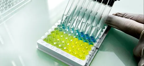 Une entreprise Montpelliéraine produit des tests sérologiques...