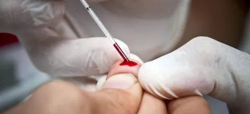 Des dépistages VIH et IST gratuits sur le Festival des Marionnettes