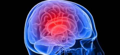 AVC : conférence sur les signes précurseurs à Charleville.