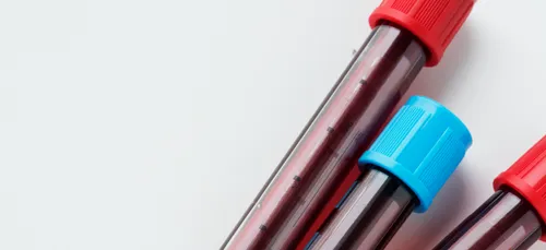 Charleville : des dépistages IST gratuits pendant le festival des...