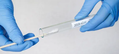 Covid-19 : la circulation des variants s'accélère dans le Grand-Est