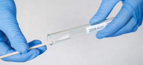 COVID-19 : Le taux d'incidence très nettement à la baisse