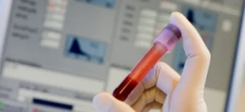 Château-Gontier : collecte de sang ce mardi