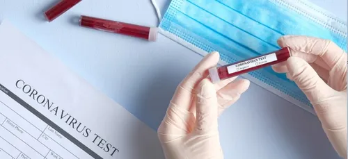 Coronavirus : un premier cas recensé dans l'Orne