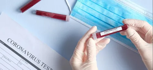 Covid-19 : 5 nouveaux cas dans l’Orne, 4 dans l’Eure