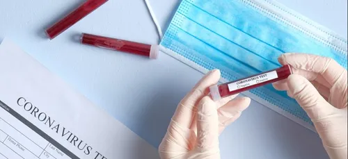 Covid-19 : l’épidémie ralentit en Pays-de-la-Loire