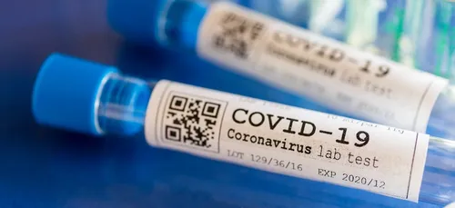 Covid-19 : 8 700 tests déjà effectués en Mayenne