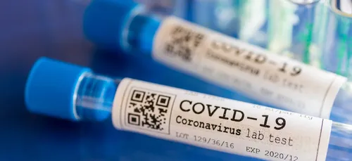 Covid-19 : opération de dépistage gratuit au Mans pendant trois jours
