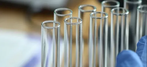 Covid-19 : dépistage gratuit à Vendôme