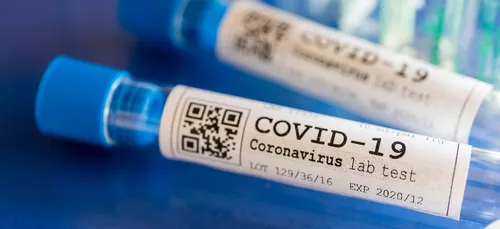 Covid-19 : la circulation du virus s’accélère en Normandie