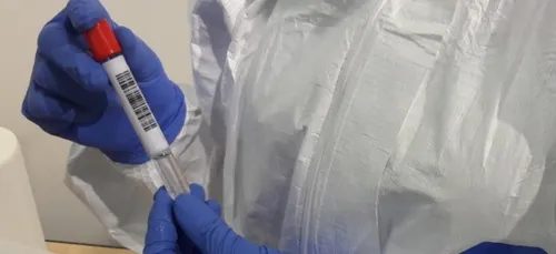 COVID-19 : le taux de positivité toujours plus élevé en Sarthe