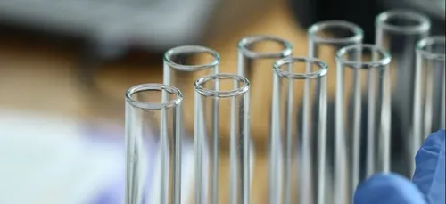 COVID-19 : l'Orne vire au rouge