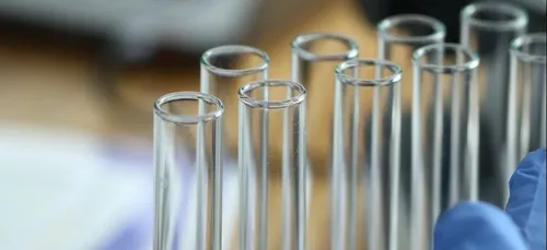 Covid-19 : dépistage gratuit ce jeudi 5 novembre à Nogent-le-Rotrou