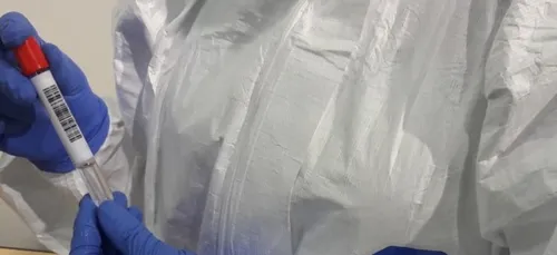 L'Orne en marge de la dégradation de la situation sanitaire