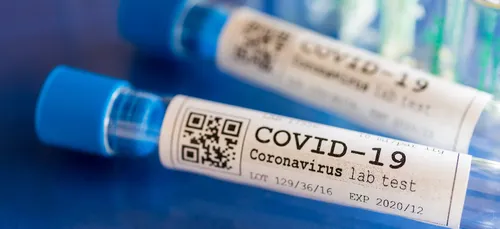 Covid-19 : le taux d'incidence supérieur à 500 dans le Perche