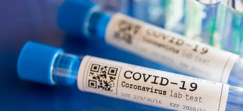 Covid-19 : 265 cas pour 100 000 habitants en Sarthe