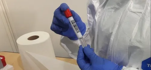 L'Aigle : opération dépistage Covid-19 ces 6 et 8 avril