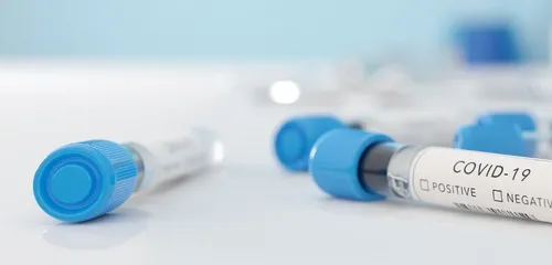 A L'Aigle, deux sessions de dépistage gratuites et sans rendez-vous