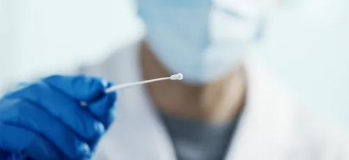 Covid-19 : dans l'Orne, le taux d'incidence repart à la hausse