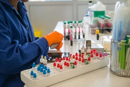 Des tests du Covid-19 plus nombreux en Alsace