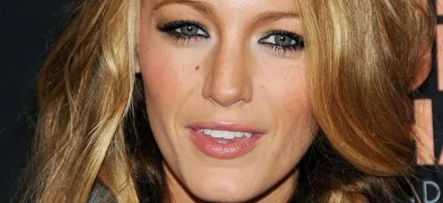 Blake Lively : Ses photos avant/après la chirurgie esthétique qui...