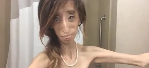 Lizzie Velasquez : le combat de "la femme la plus moche du monde" !