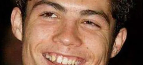 Toutes ces stars peuvent dire "merci" au progrès de la  chirurgie...