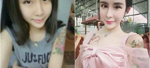 15 ans et déjà accro à la chirurgie esthétique...