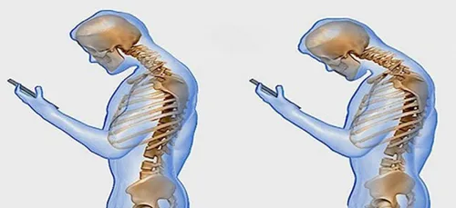 Le smartphone et votre colonne vertébrale ne font pas bon ménage !