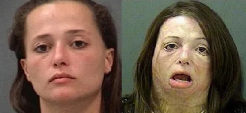 Le Crystal Meth fait des ravages ! (photos)