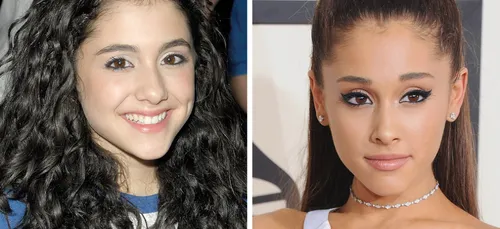 Ces célébrités qui ont bien (ou mal) changé ! (photos)