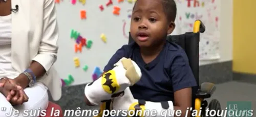 Un petit garçon de 8 ans se fait greffer les deux mains ! (vidéo)