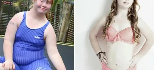 18 ANS, ATTEINTE DE TRISOMIE 21 ET  MANNEQUIN ?