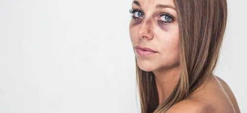 Une femme victime de violences conjugales fait un shooting photo...