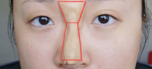 Se refaire le nez à la maison... C'est possible ! (photos)